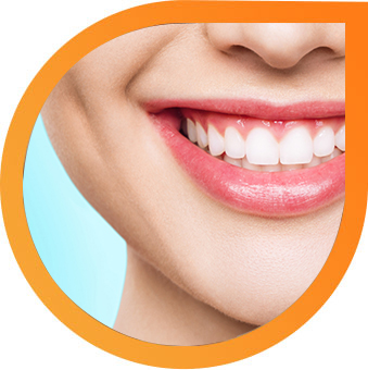braces-aligners-img-1